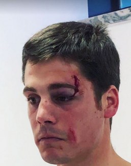 Всадник команды Португалии по выездке Васко Мира Годиньо жестоко избит на национальном турнире